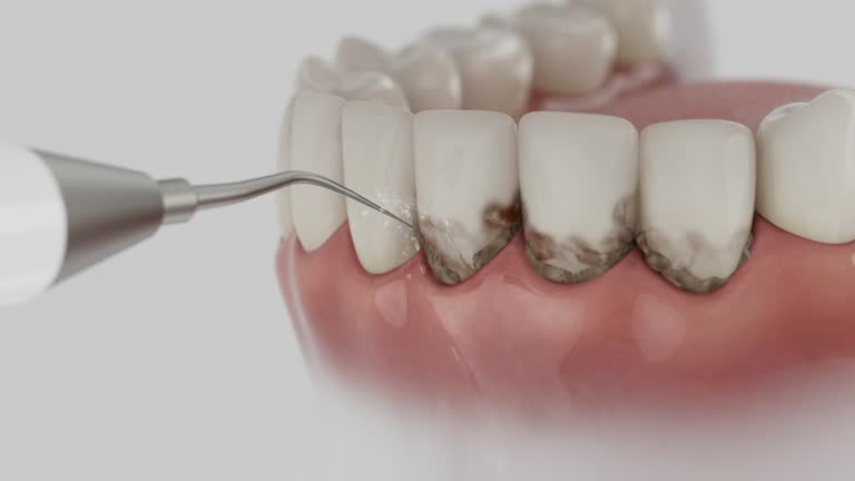 Trusted Invisalign Clear Aligners service in McGovern, PA - Dentist Open Now